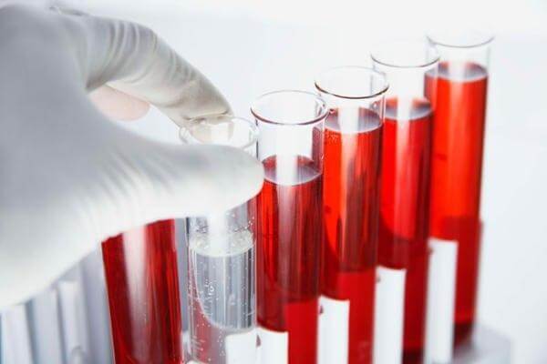Исследования уровня гормонов в крови при мастопатии