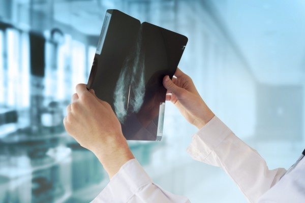 Проведение рентгенографии при диагностике мастопатии